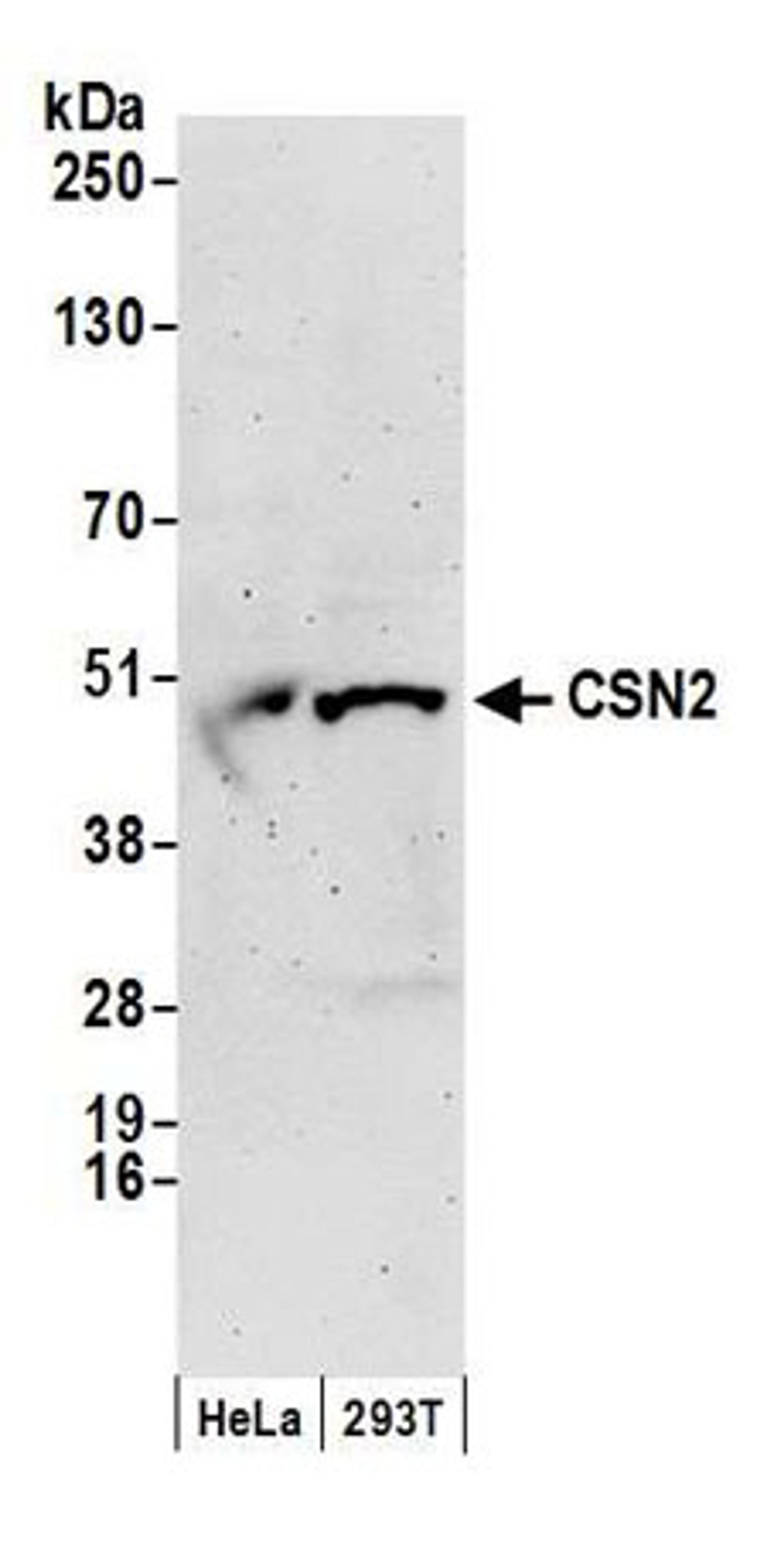 Detection of human CSN2 by western blot.