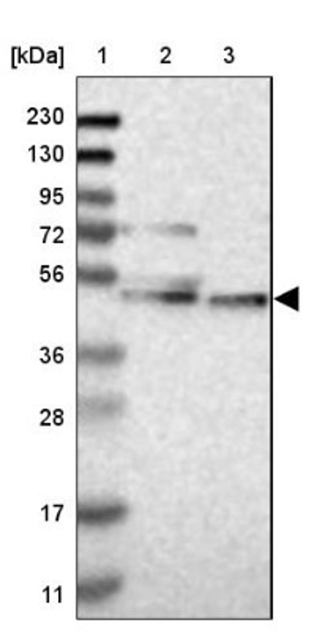 Western Blot: Cytochrome P450 26B1 Antibody [NBP1-87371] - Lane 1: Marker [kDa] 230, 130, 95, 72, 56, 36, 28, 17, 11<br/>Lane 2: Human cell line RT-4<br/>Lane 3: Human cell line U-251MG sp