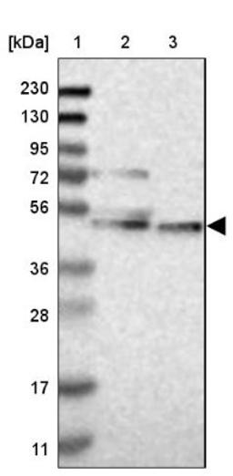 Western Blot: Cytochrome P450 26B1 Antibody [NBP1-87371] - Lane 1: Marker [kDa] 230, 130, 95, 72, 56, 36, 28, 17, 11<br/>Lane 2: Human cell line RT-4<br/>Lane 3: Human cell line U-251MG sp