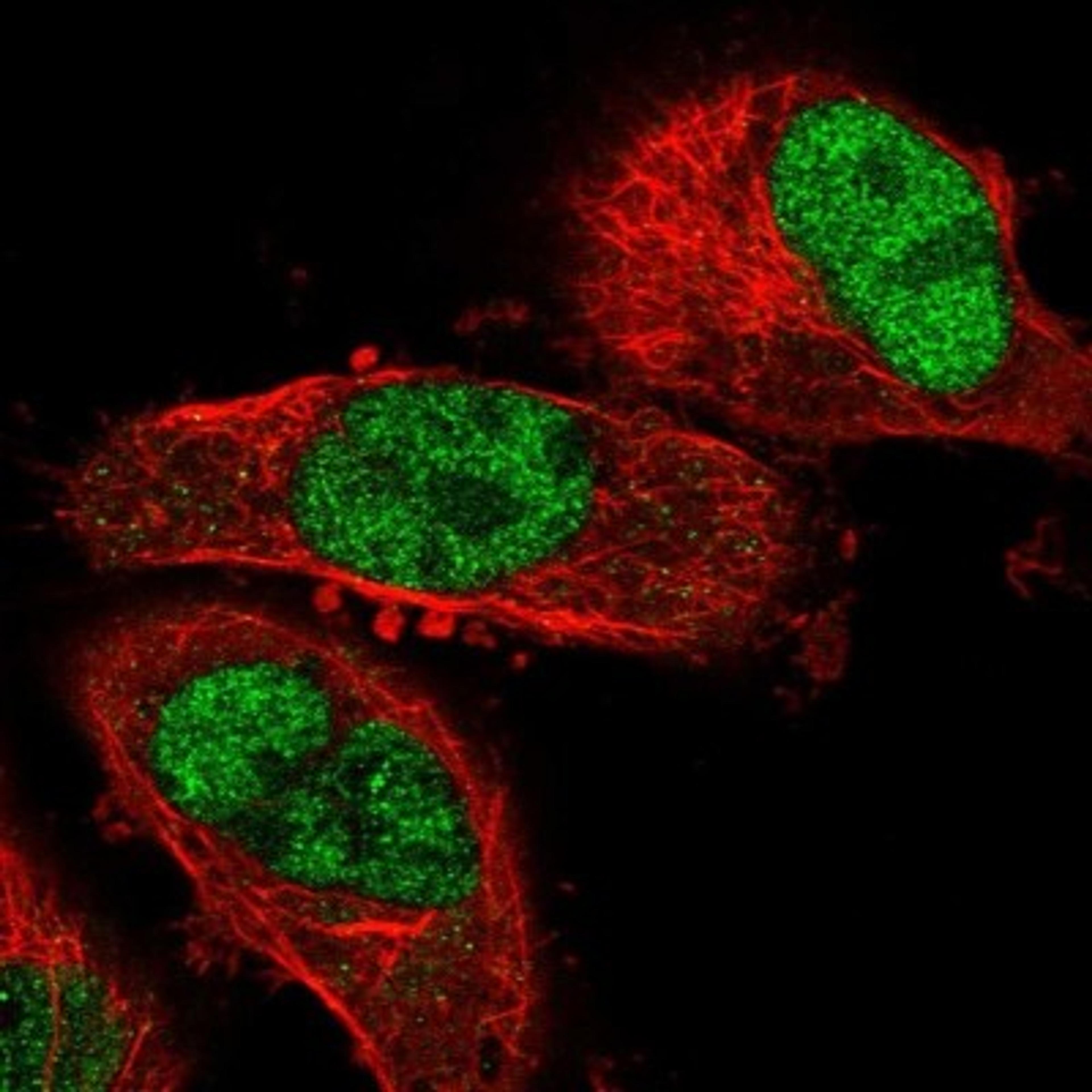 Immunocytochemistry/Immunofluorescence: RASGEF1B Antibody [NBP1-82015] - Staining of human cell line U-251 MG shows positivity in nucleus but not nucleoli.