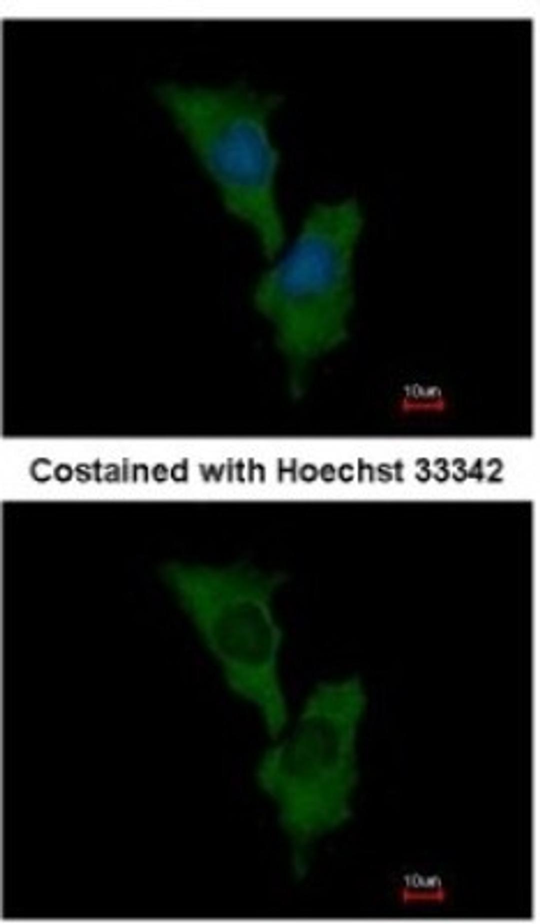 Immunocytochemistry/Immunofluorescence: ELMO1 Antibody [NBP1-33645] - Analysis of methanol-fixed HeLa, using antibody at 1:500 dilution.