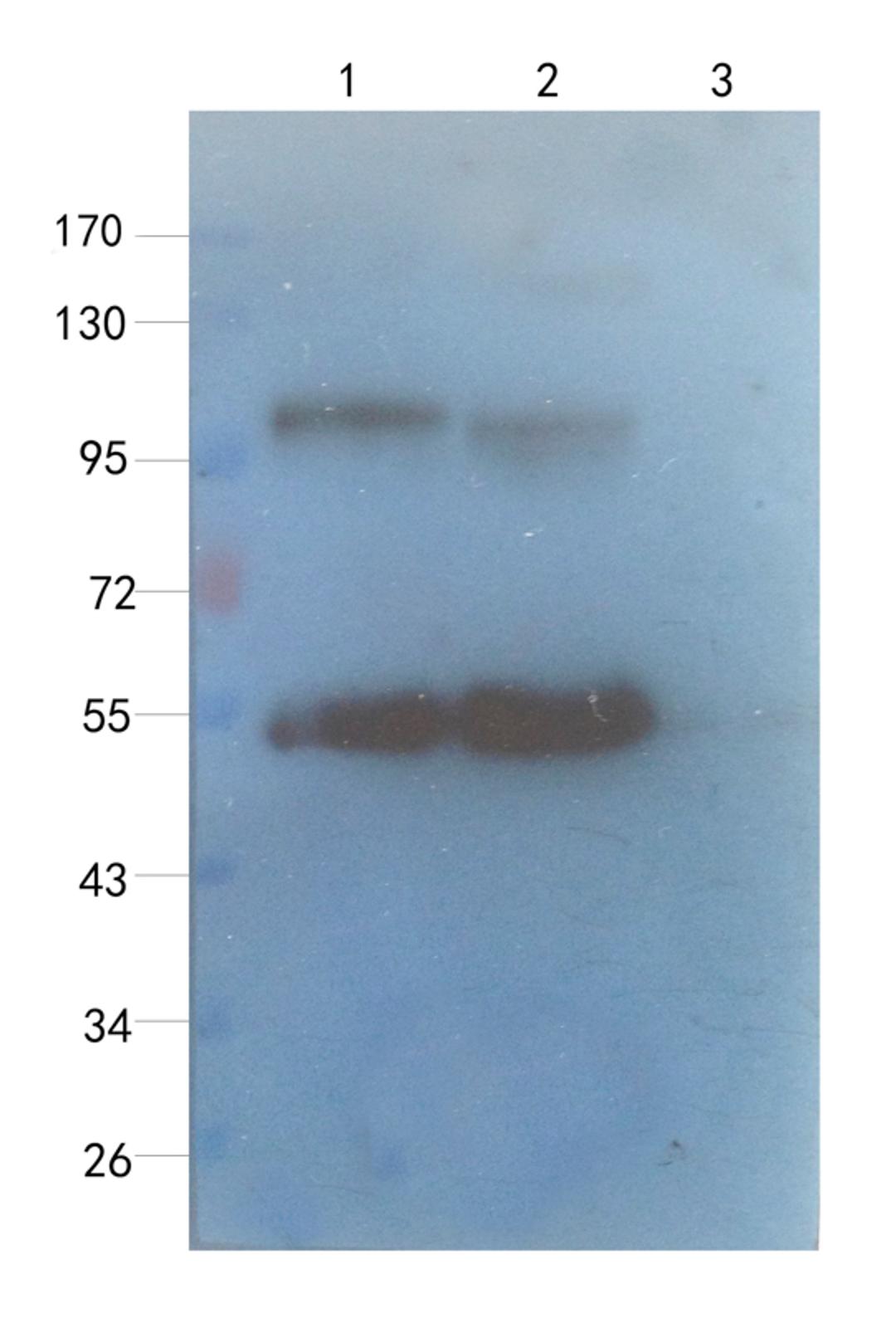 WB analysis of rat lung (lane 1), human breast cancer (lane 2), human thyroid cancer (lane 3), using Sialoadhesin antibody (1 ug/ml)