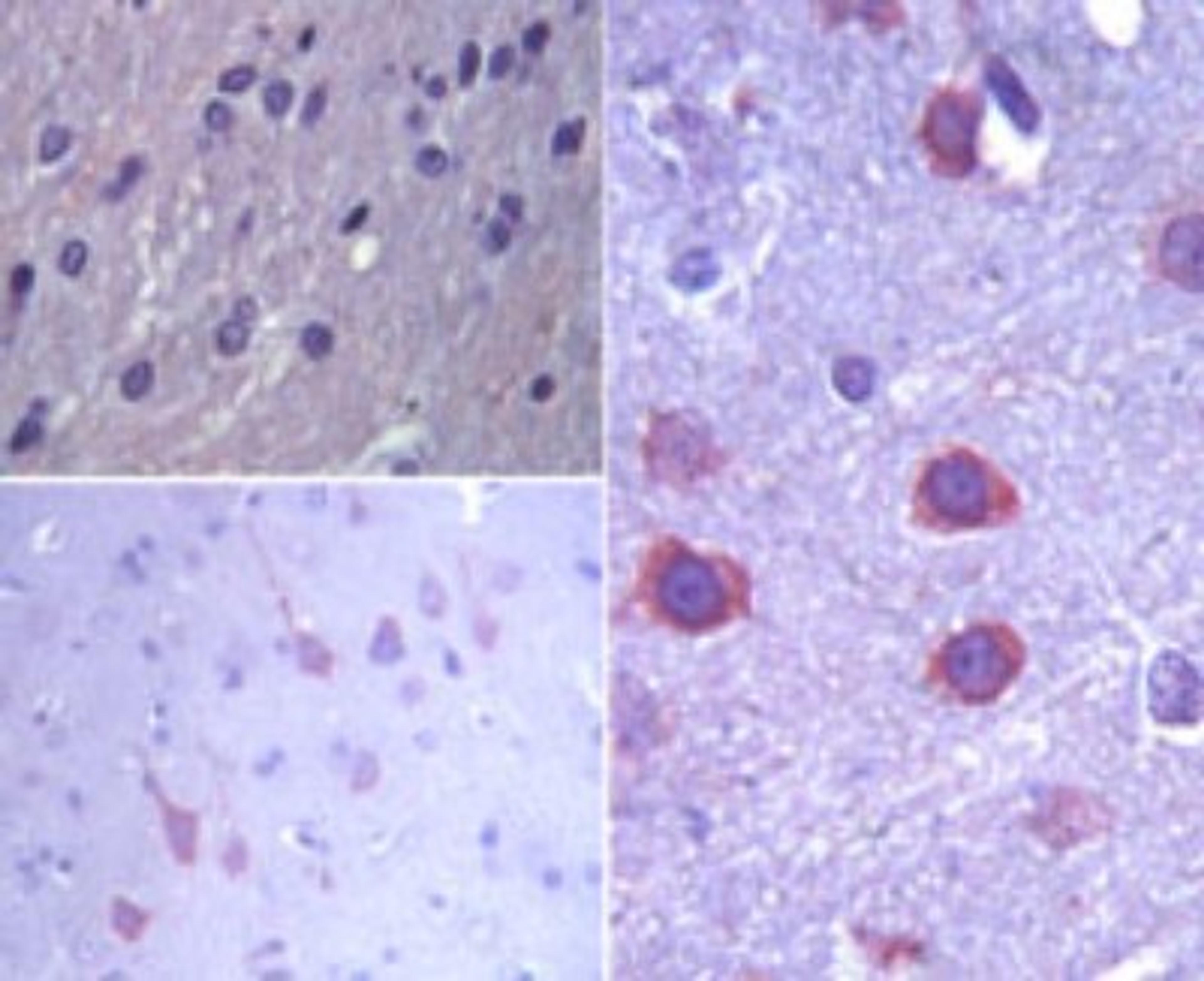 Immunohistochemistry-Paraffin: ERAS Antibody [NBP2-23727] - analysis of ERAS in paraffin-embedded formalin-fixed rat brain tissue using an isotype control (top, left) and this antibody (bottom left, and right) at 1:100.