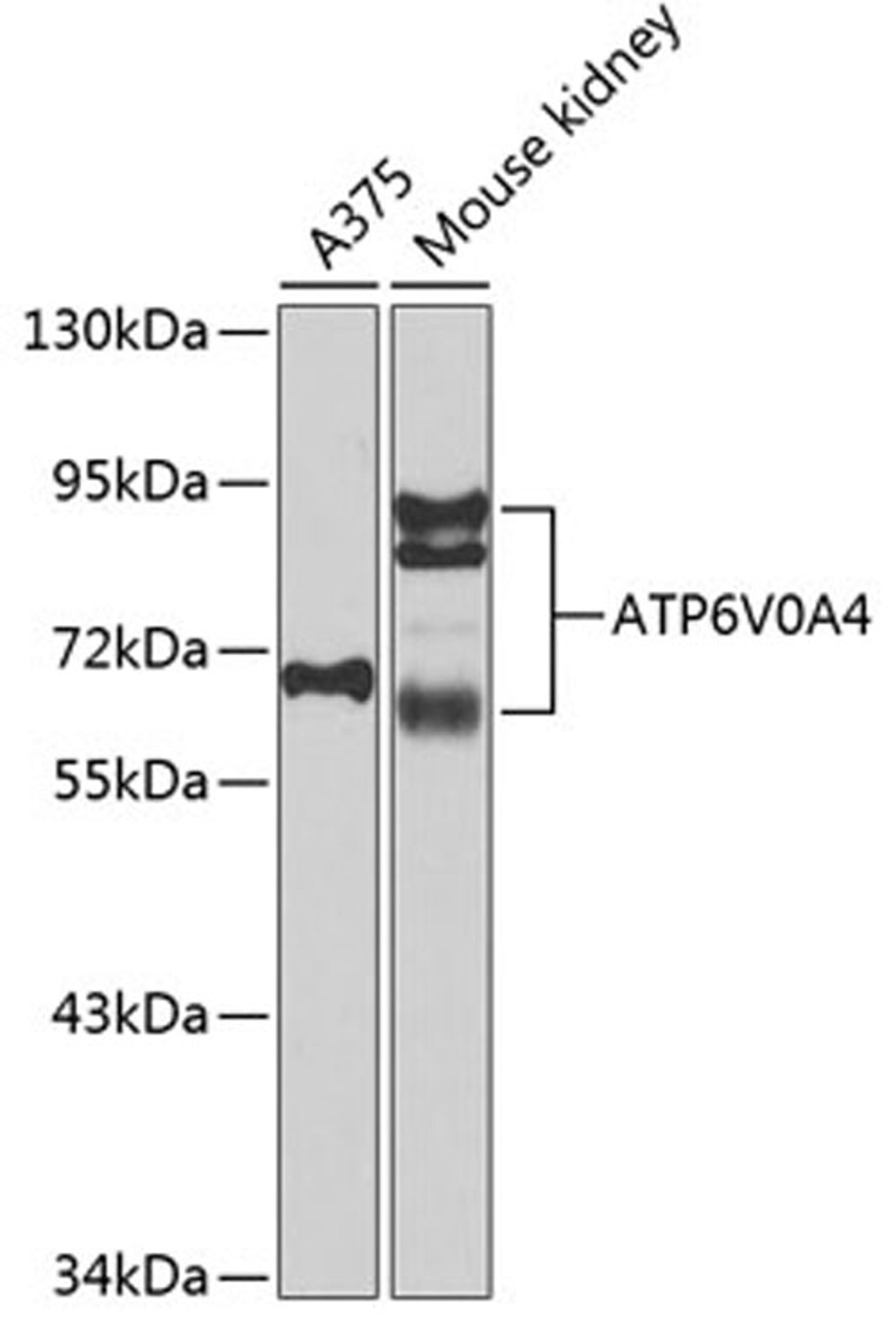 Western blot - ATP6V0A4 antibody (A7591)