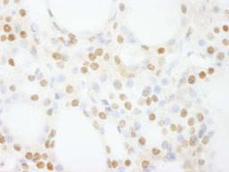 Detection of human GTF3C4/TFIIIC90 by immunohistochemistry.