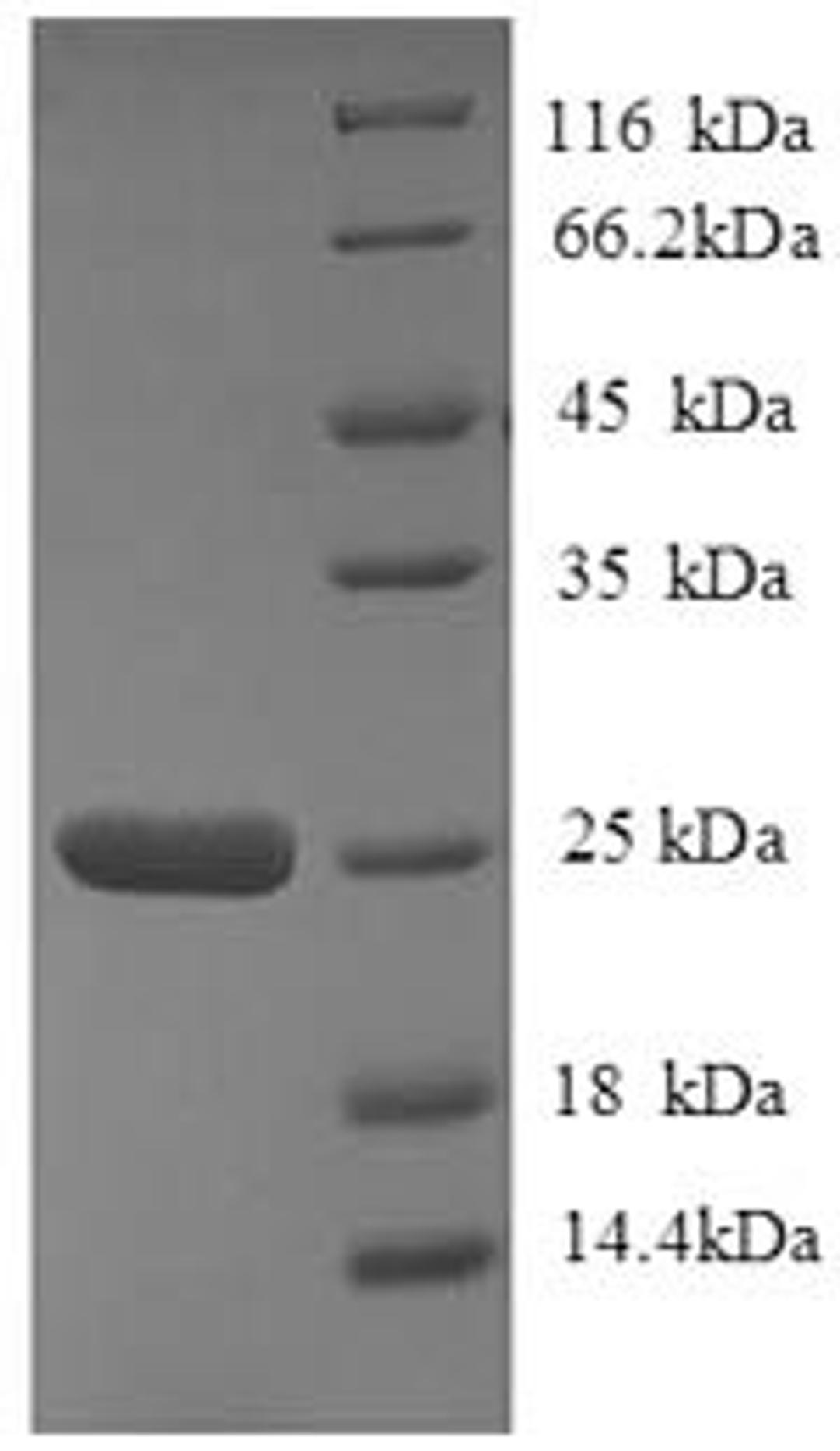 (Tris-Glycine gel) Discontinuous SDS-PAGE (reduced) with 5% enrichment gel and 15% separation gel.