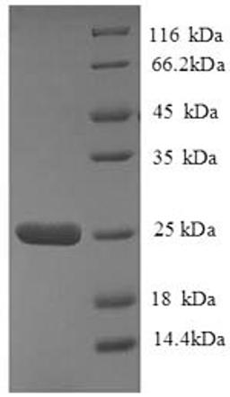 (Tris-Glycine gel) Discontinuous SDS-PAGE (reduced) with 5% enrichment gel and 15% separation gel.