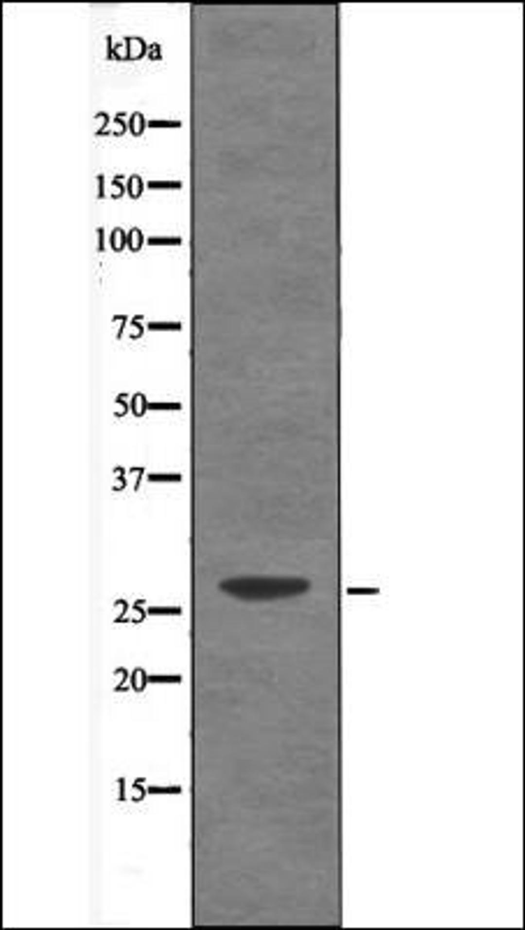 Western blot analysis of UV treated Jurkat whole cell lysates using Caveolin 2 -Phospho-Tyr19- antibody