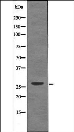 Western blot analysis of UV treated Jurkat whole cell lysates using Caveolin 2 -Phospho-Tyr19- antibody