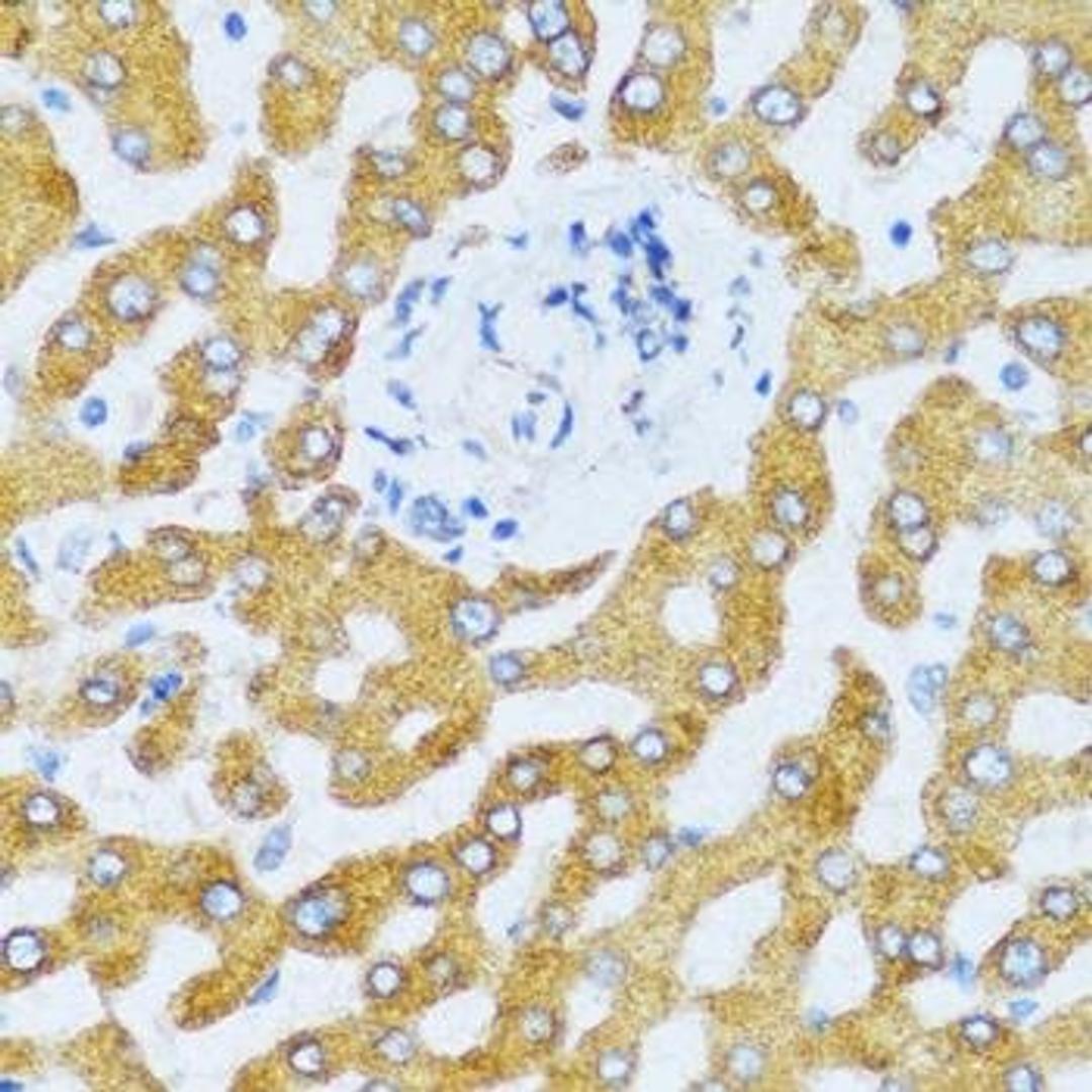 Immunohistochemical staining of human liver tissue using CCL25 antibody (dilution of 1:100)