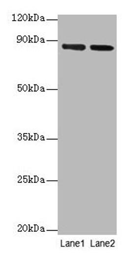 Western blot. All lanes: FOLH1 antibody at 2µg/ml. Lane 1: U251 whole cell lysate. Lane 2: PC-3 whole cell lysate. Secondary. Goat polyclonal to rabbit IgG at 1/10000 dilution. Predicted band size: 85, 13, 10, 78, 83, 81, 79, 51 kDa. Observed band size: 85 kDa