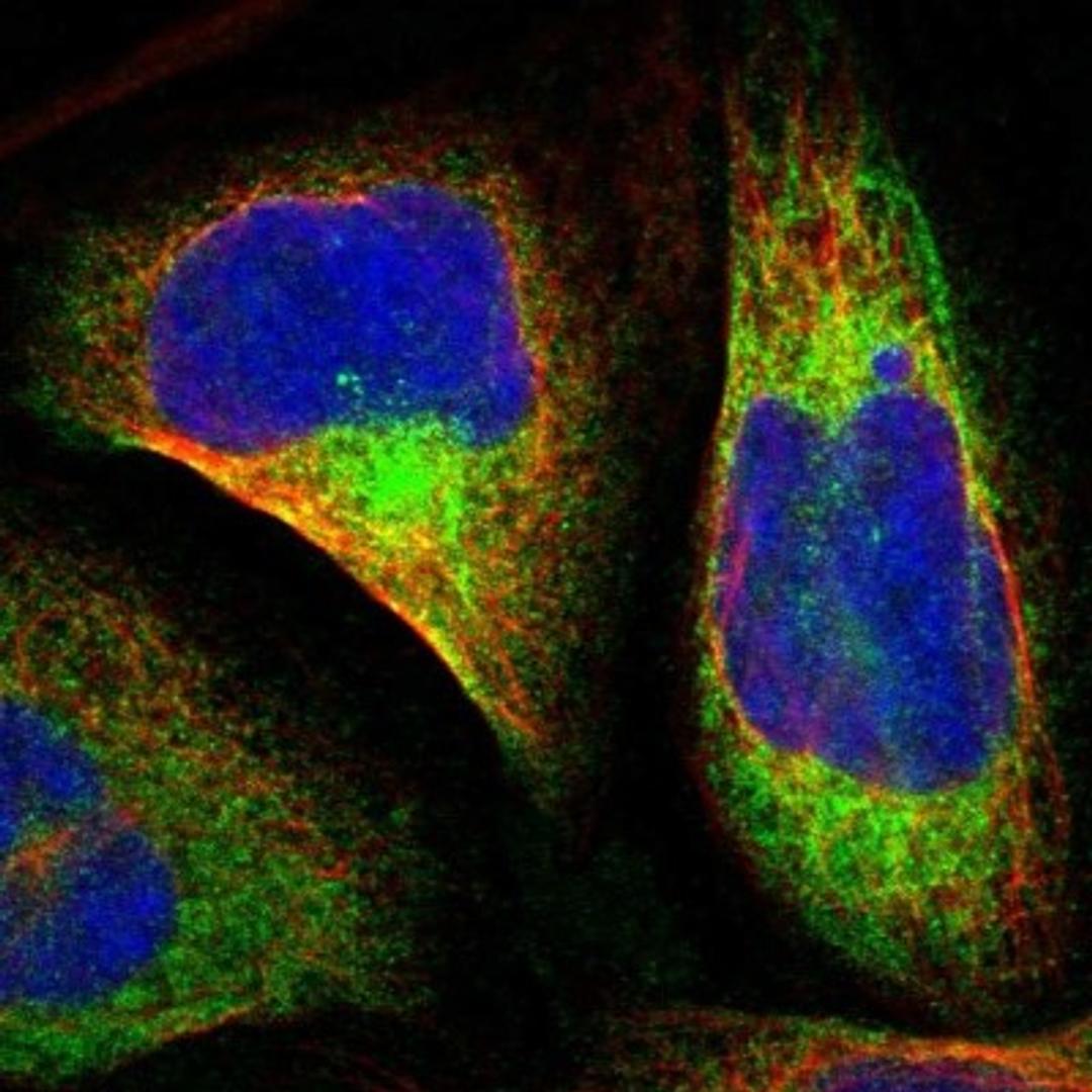 Immunocytochemistry/Immunofluorescence: PRR11 Antibody [NBP1-83784] - Staining of human cell line U-2 OS shows positivity in cytoskeleton (intermediate filaments).