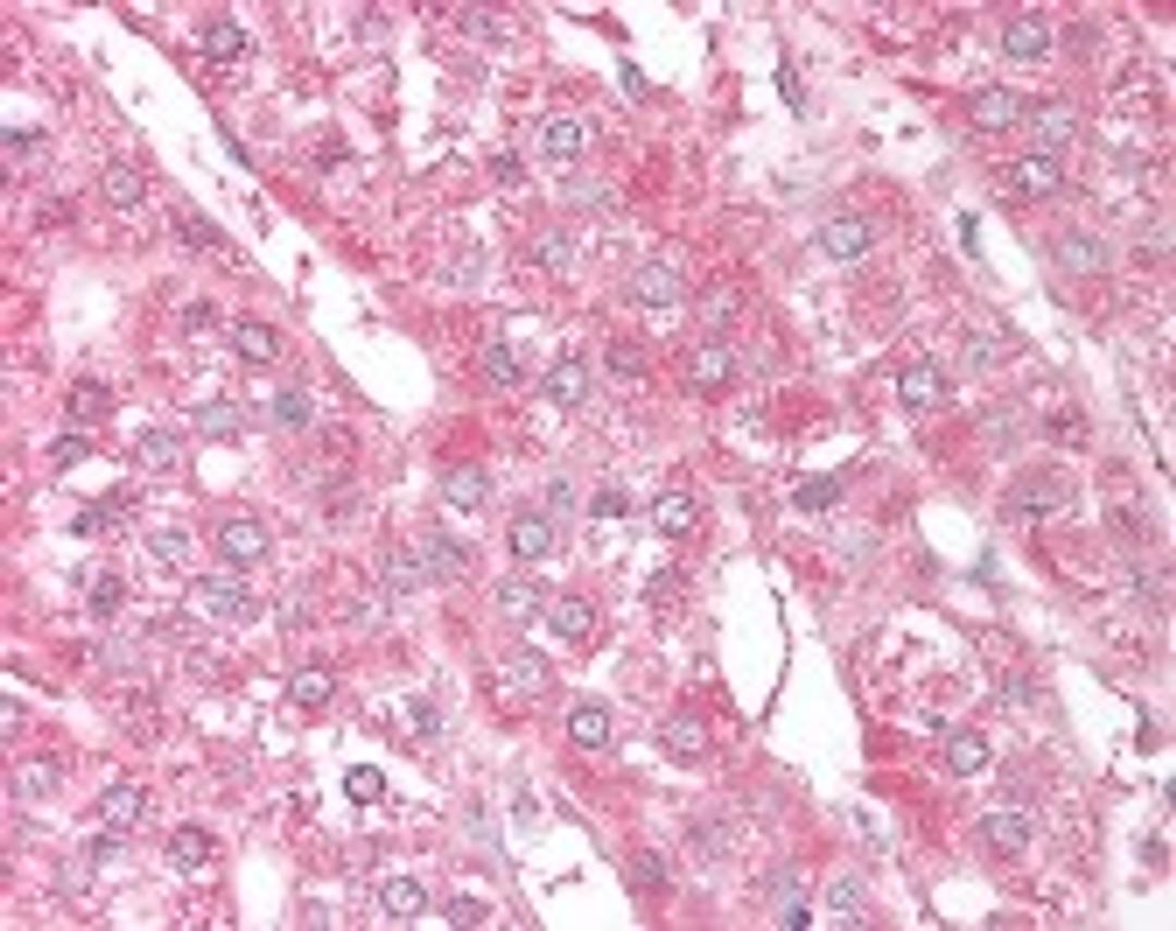 Immunohistochemistry staining of ST13 in adrenal (formalin-fixed paraffin embedded) tissue using ST13 Antibody.