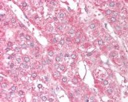 Immunohistochemistry staining of ST13 in adrenal (formalin-fixed paraffin embedded) tissue using ST13 Antibody.