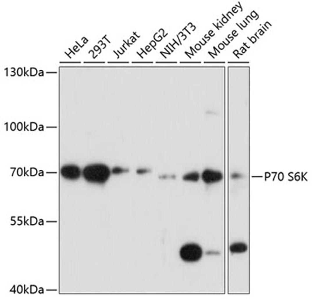 Western blot - P70 S6K antibody (A16968)