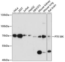 Western blot - P70 S6K antibody (A16968)