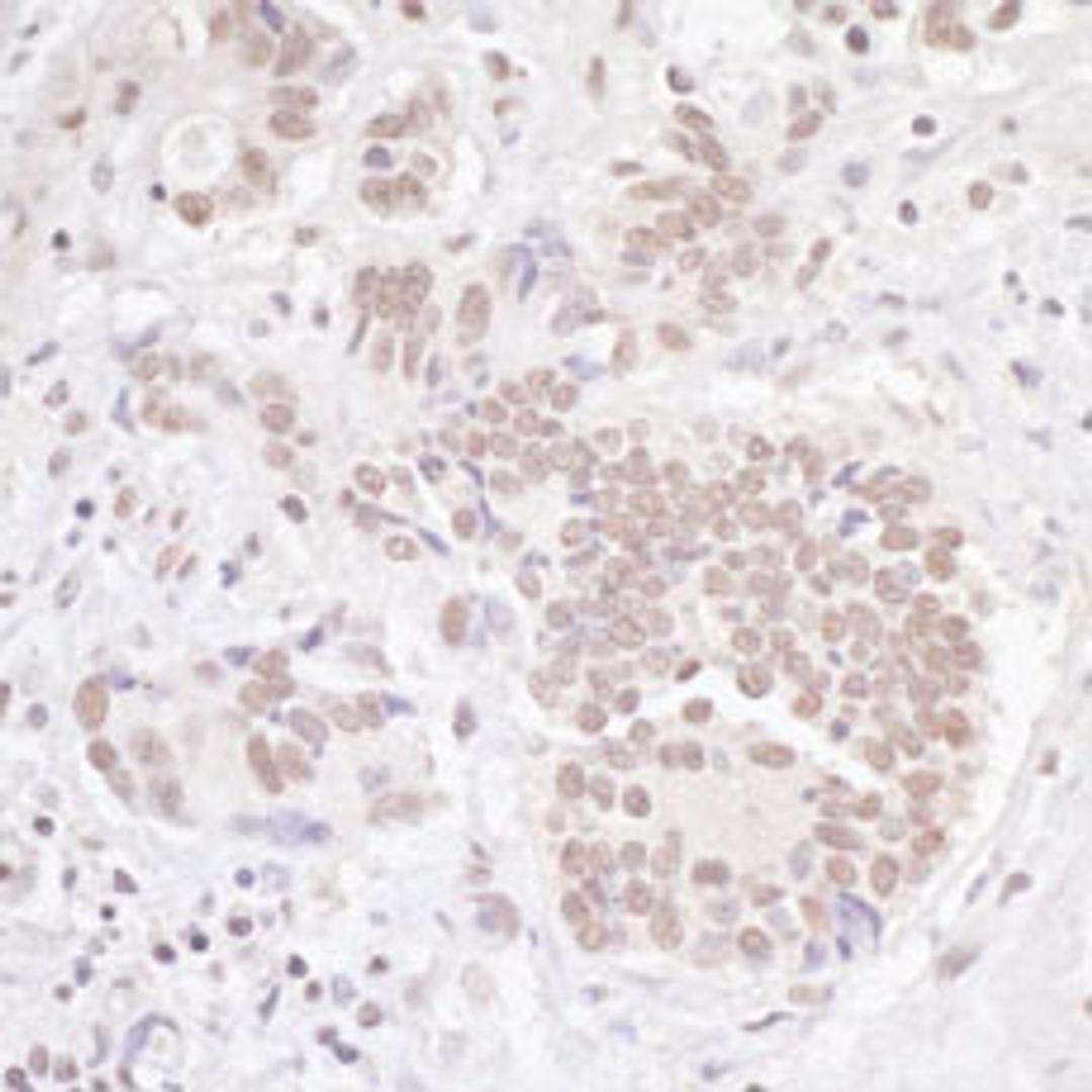 Detection of human TBLR1 by immunohistochemistry.