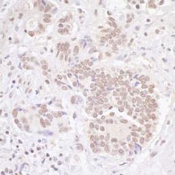 Detection of human TBLR1 by immunohistochemistry.