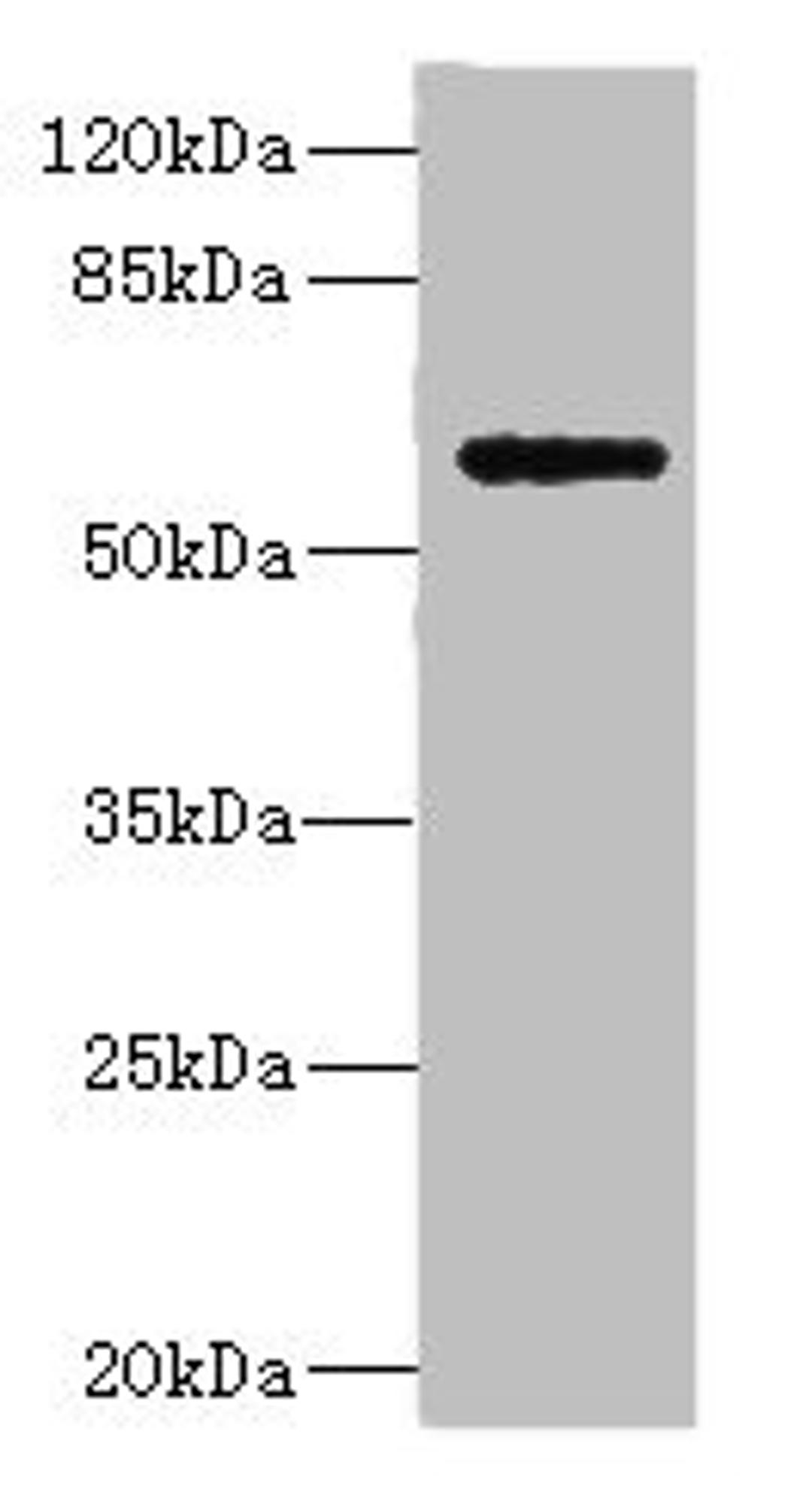 Western blot. All lanes: COX10 antibody at 5.84ug/ml + Mouse heart tissue. Secondary. Goat polyclonal to rabbit IgG at 1/10000 dilution. Predicted band size: 61, 60, 63 kDa. Observed band size: 61 kDa. 