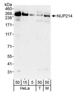 Detection of human and mouse NUP214 by western blot.