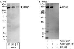 Detection of human MCSP by western blot and immunoprecipitation.