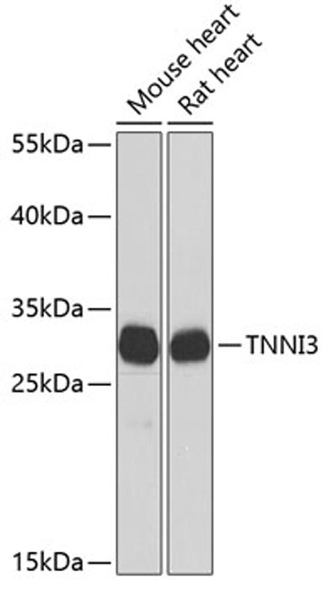 Western blot - TNNI3 antibody (A0152)