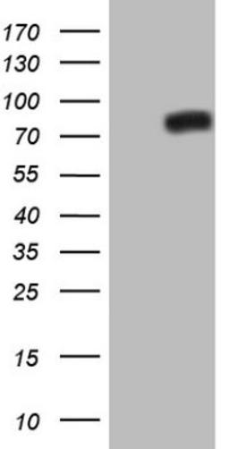 Western Blot: NR4A3/NOR1 Antibody (5C2) [NBP2-46246] - Analysis of HEK293T cells were transfected with the pCMV6-ENTRY control (Left lane) or pCMV6-ENTRY NR4A3.