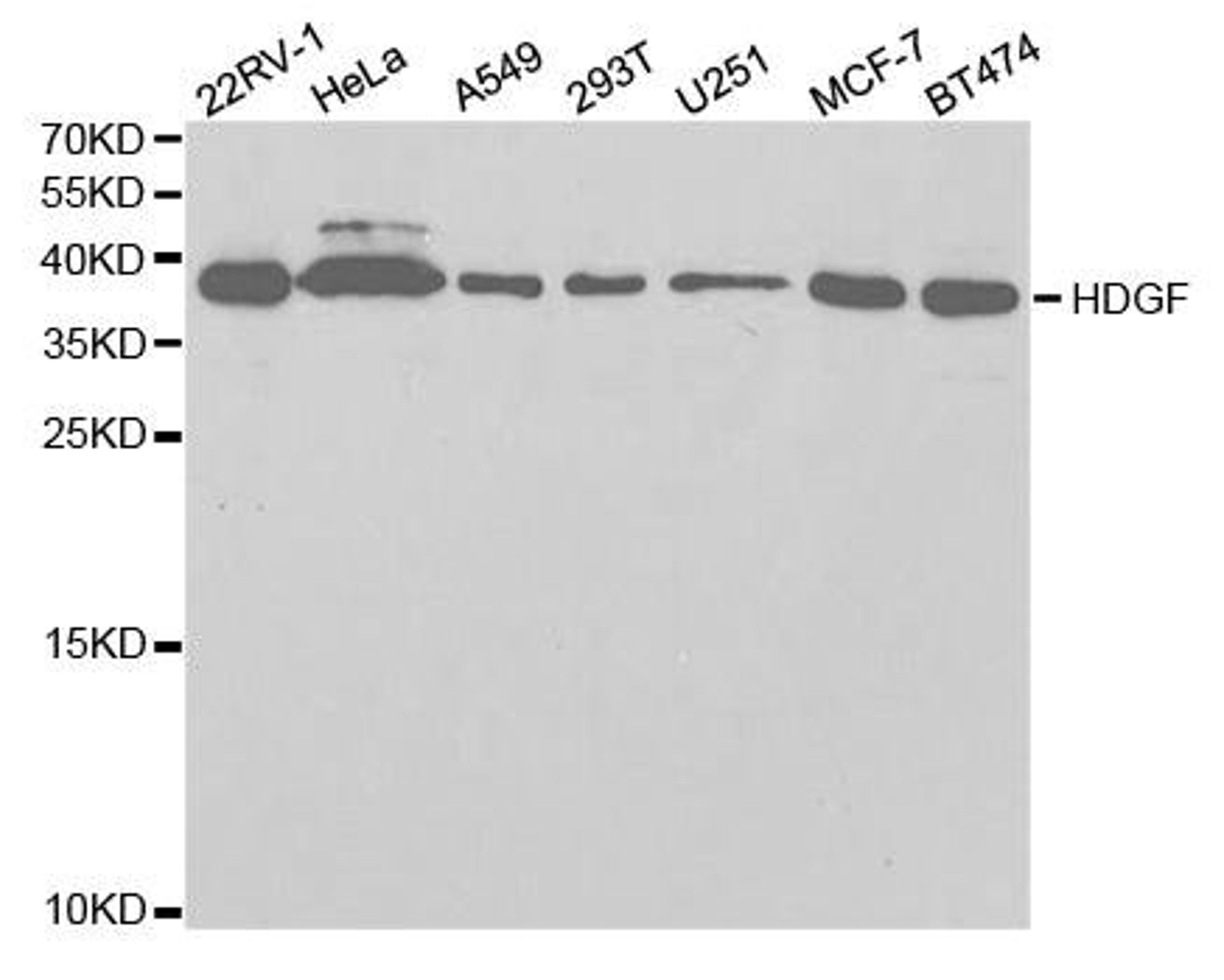 Western blot analysis of extracts of various cell lines using HDGF antibody