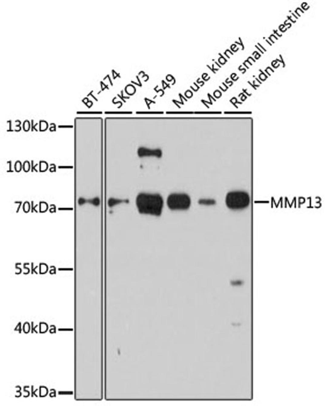 Western blot - MMP13 antibody (A11755)