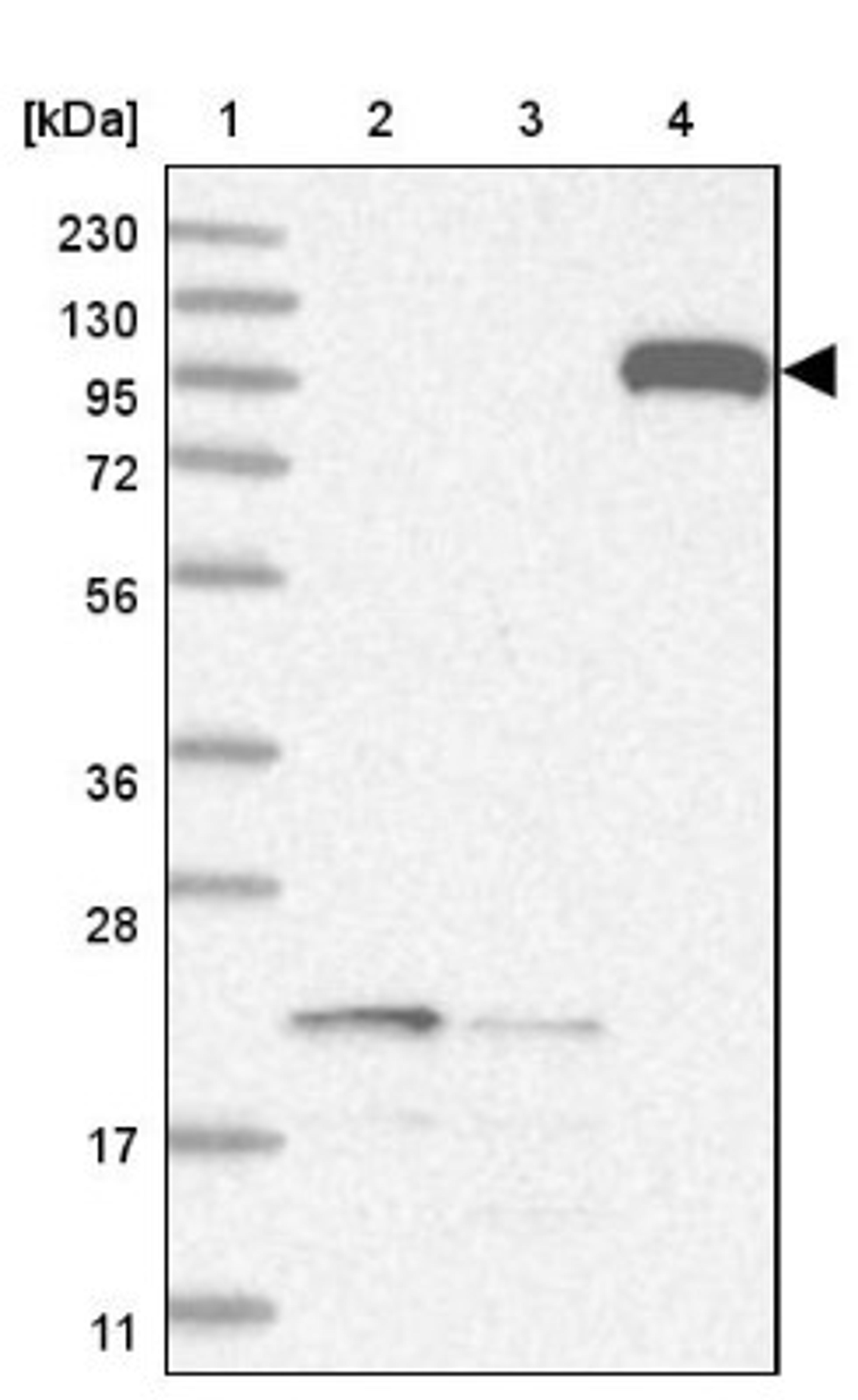 Western Blot: ADAM12 Antibody [NBP2-33939] - Lane 1: Marker [kDa] 230, 130, 95, 72, 56, 36, 28, 17, 11<br/>Lane 2: Human cell line RT-4<br/>Lane 3: Human cell line U-251MG sp<br/>Lane 4: Human plasma (IgG/HSA depleted)