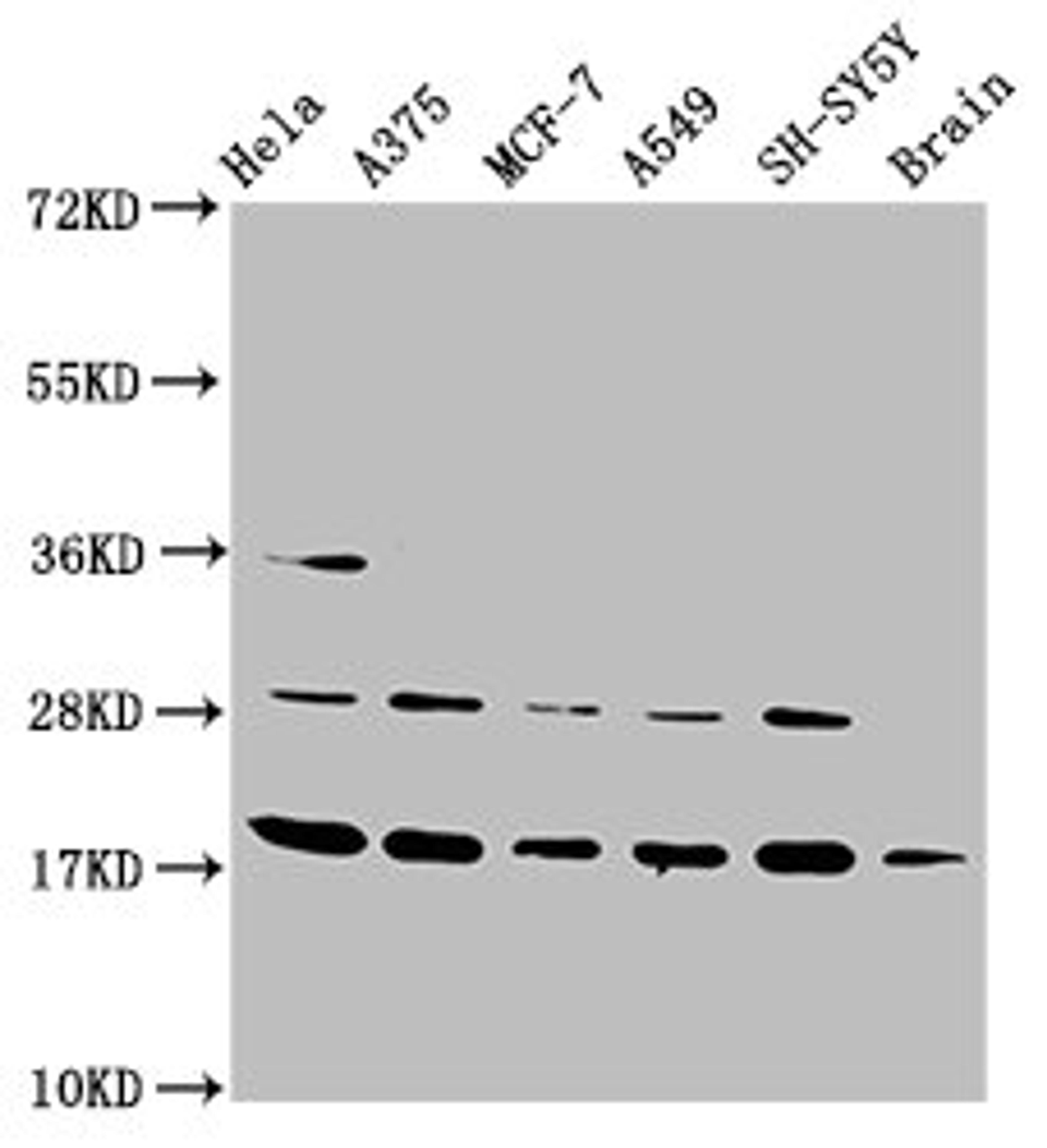 Western Blot. Positive WB detected in: Hela whole cell lysate, A375 whole cell lysate, MCF-7 whole cell lysate, A549 whole cell lysate, SH-SY5Y whole cell lysate, Rat brain tissue. All lanes: DAZAP2 antibody at 3.5µg/ml. Secondary. Goat polyclonal to rabbit IgG at 1/50000 dilution. Predicted band size: 18, 17, 16, 14, 10, 23 kDa. Observed band size: 18 kDa
