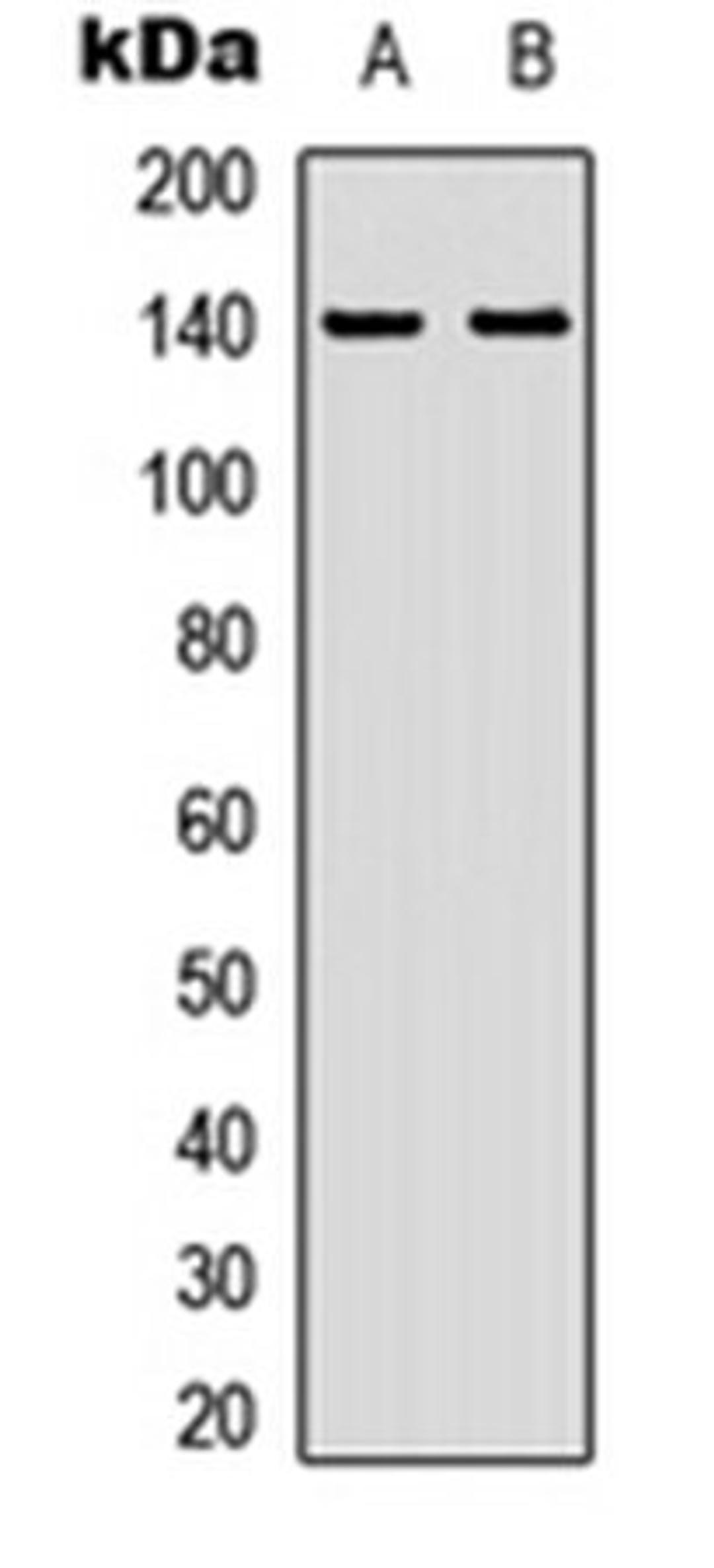 Western blot analysis of HEK293T (Lane 1), HepG2 (Lane 2) whole cell lysates using ZC3H4 antibody