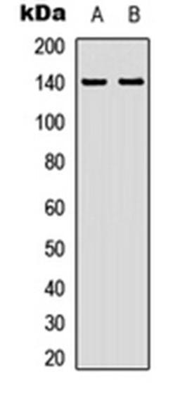 Western blot analysis of HEK293T (Lane 1), HepG2 (Lane 2) whole cell lysates using ZC3H4 antibody