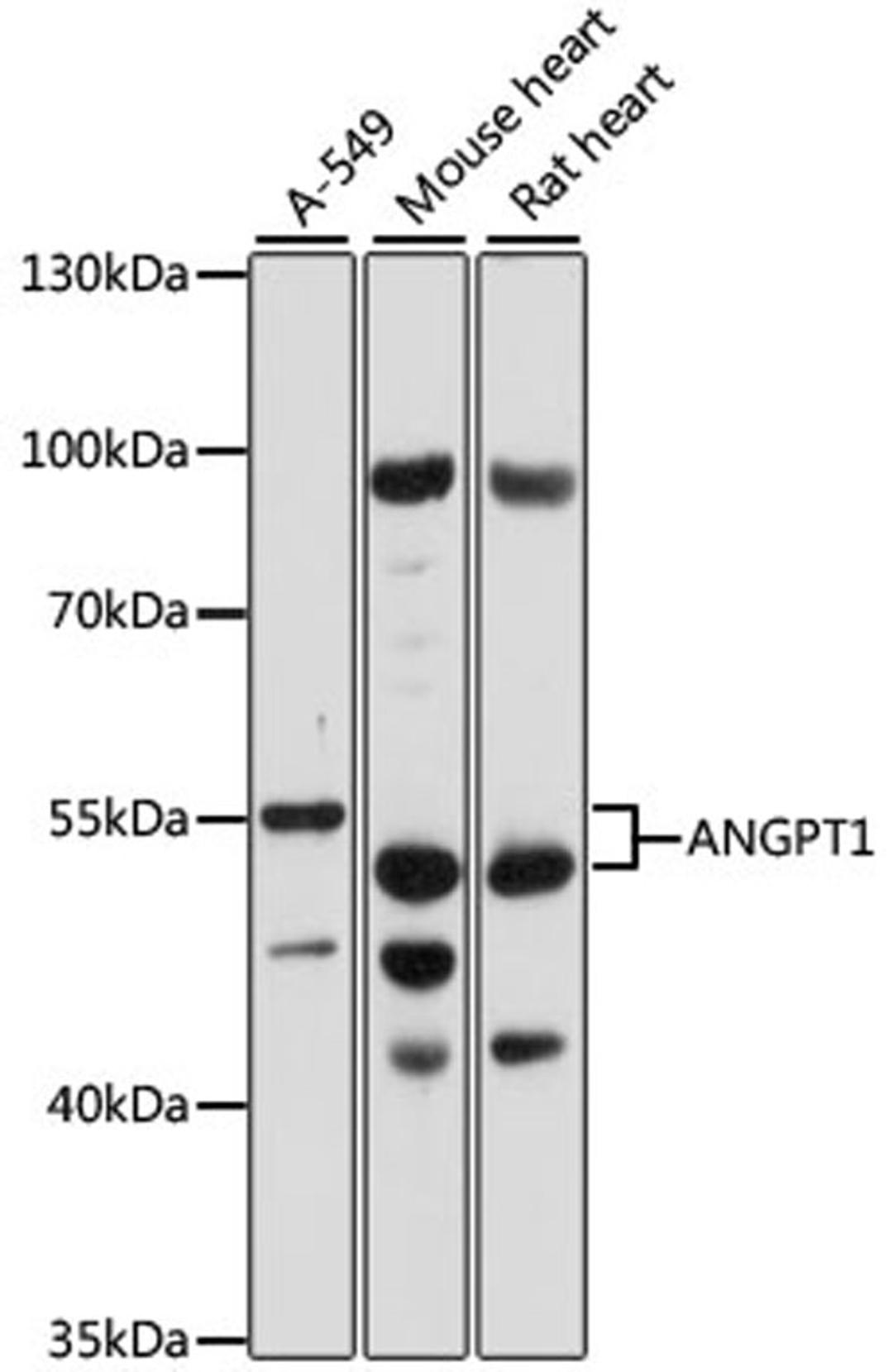 Western blot - ANGPT1 antibody (A15026)