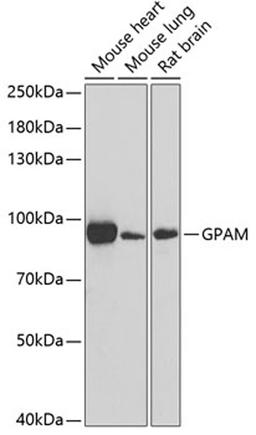 Western blot - GPAM antibody (A6610)