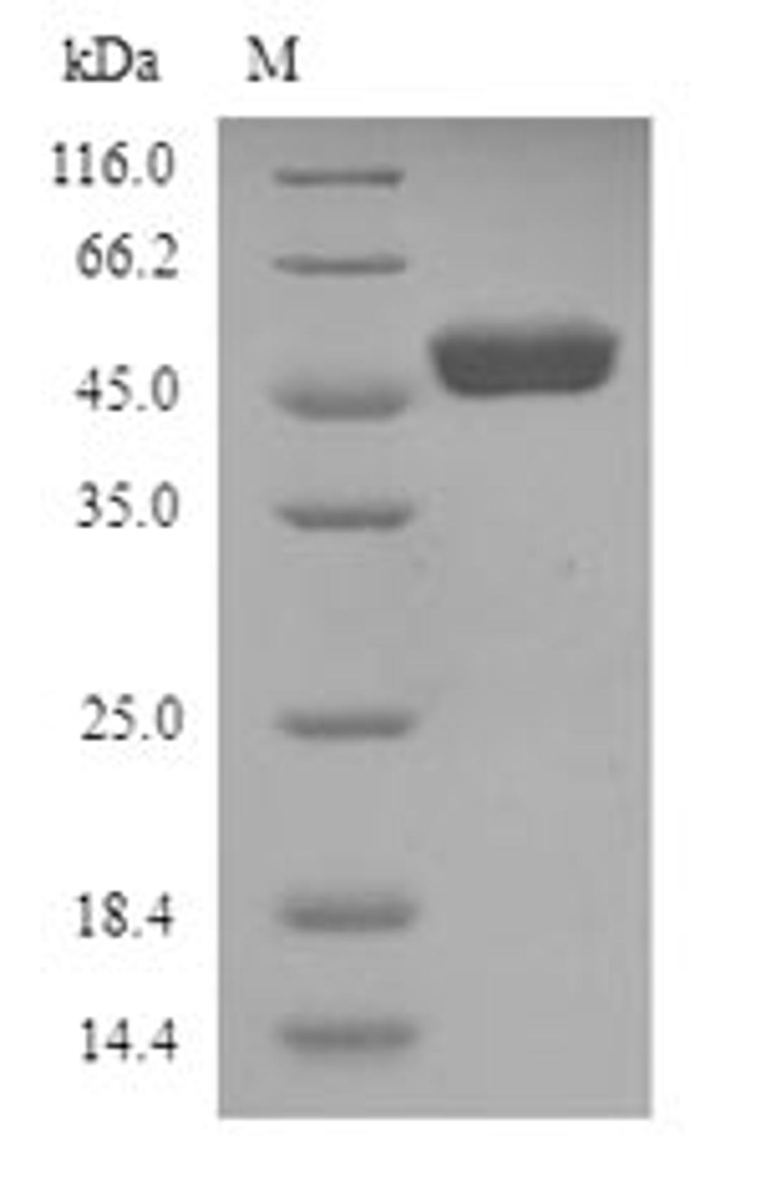 (Tris-Glycine gel) Discontinuous SDS-PAGE (reduced) with 5% enrichment gel and 15% separation gel.