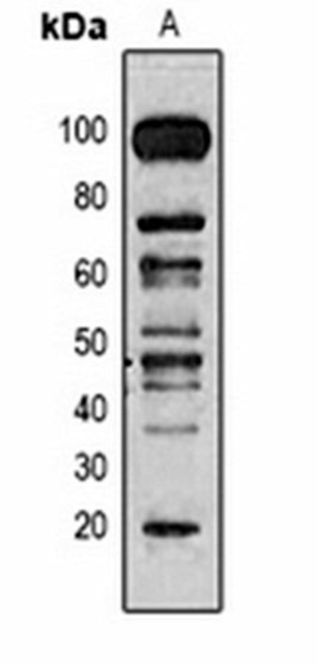 Western blot analysis of Hela (Lane 1) whole cell lysates using Methyl Lysine antibody