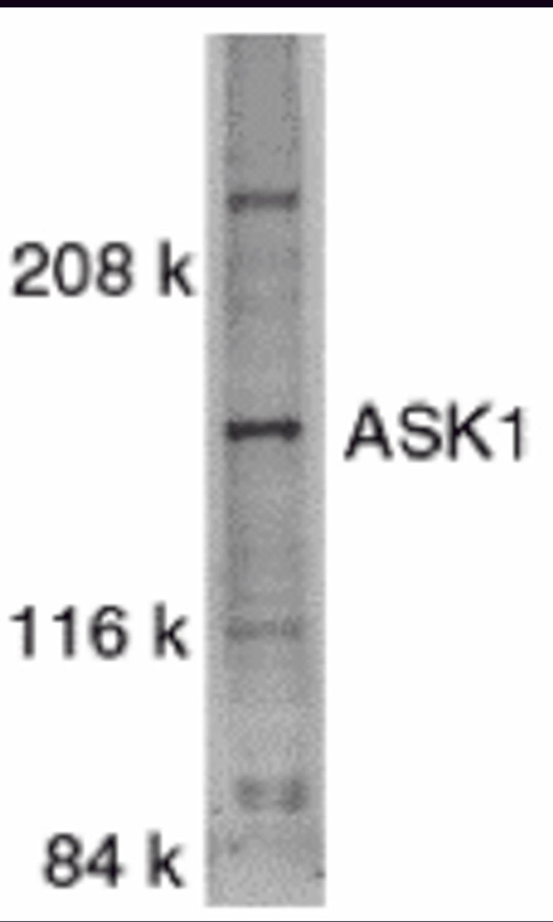 Western blot analysis of ASK1 in SW1353 whole cell lysate with ASK1 antibody at 1:500 dilution.