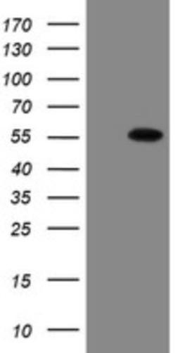 Western Blot: ERR gamma/NR3B3 Antibody (1E5) [NBP2-45698] - Analysis of HEK293T cells were transfected with the pCMV6-ENTRY control (Left lane) or pCMV6-ENTRY ERR gamma.