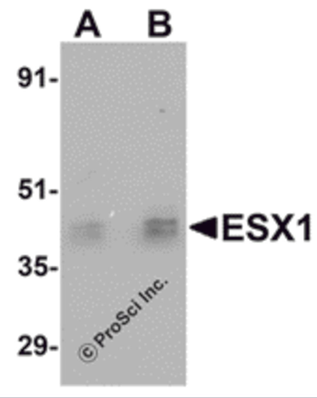 Western blot analysis of ESX1 in human testis tissue lysate with ESX1 antibody at (A) 1 and (B) 2 μg/mL.