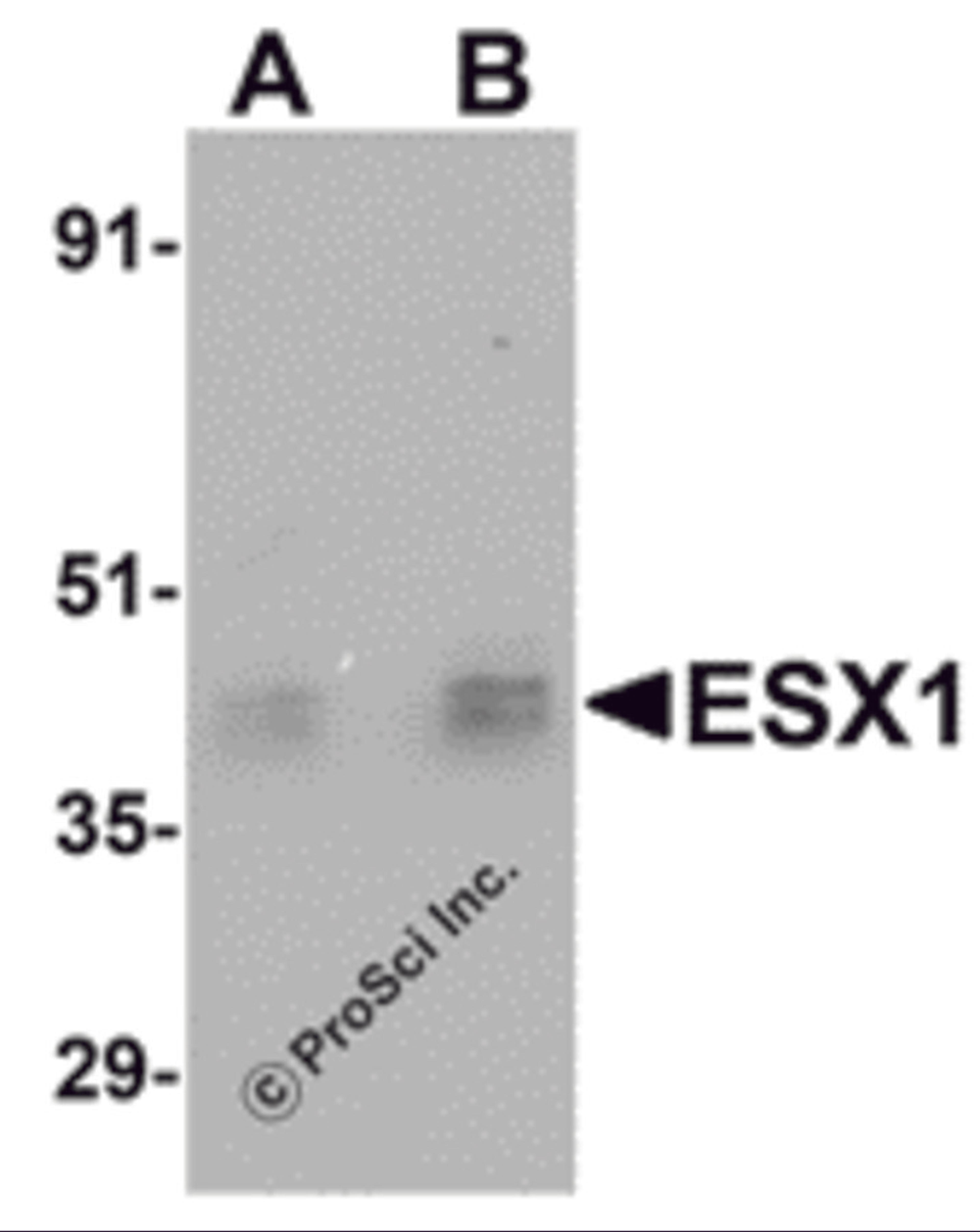 Western blot analysis of ESX1 in human testis tissue lysate with ESX1 antibody at (A) 1 and (B) 2 μg/mL.