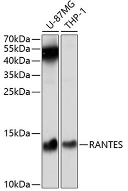 Western blot - RANTES antibody (A5630)