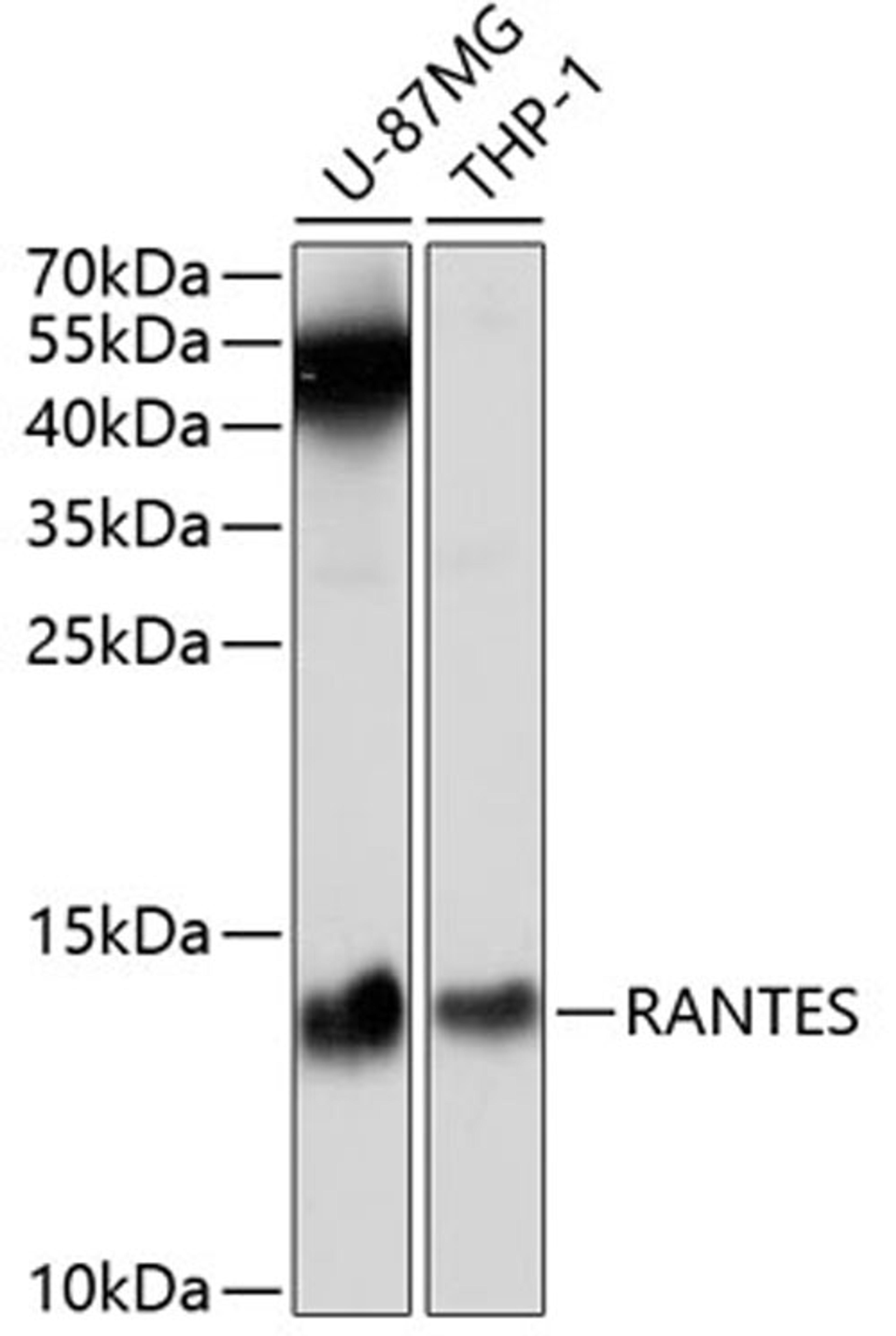 Western blot - RANTES antibody (A5630)