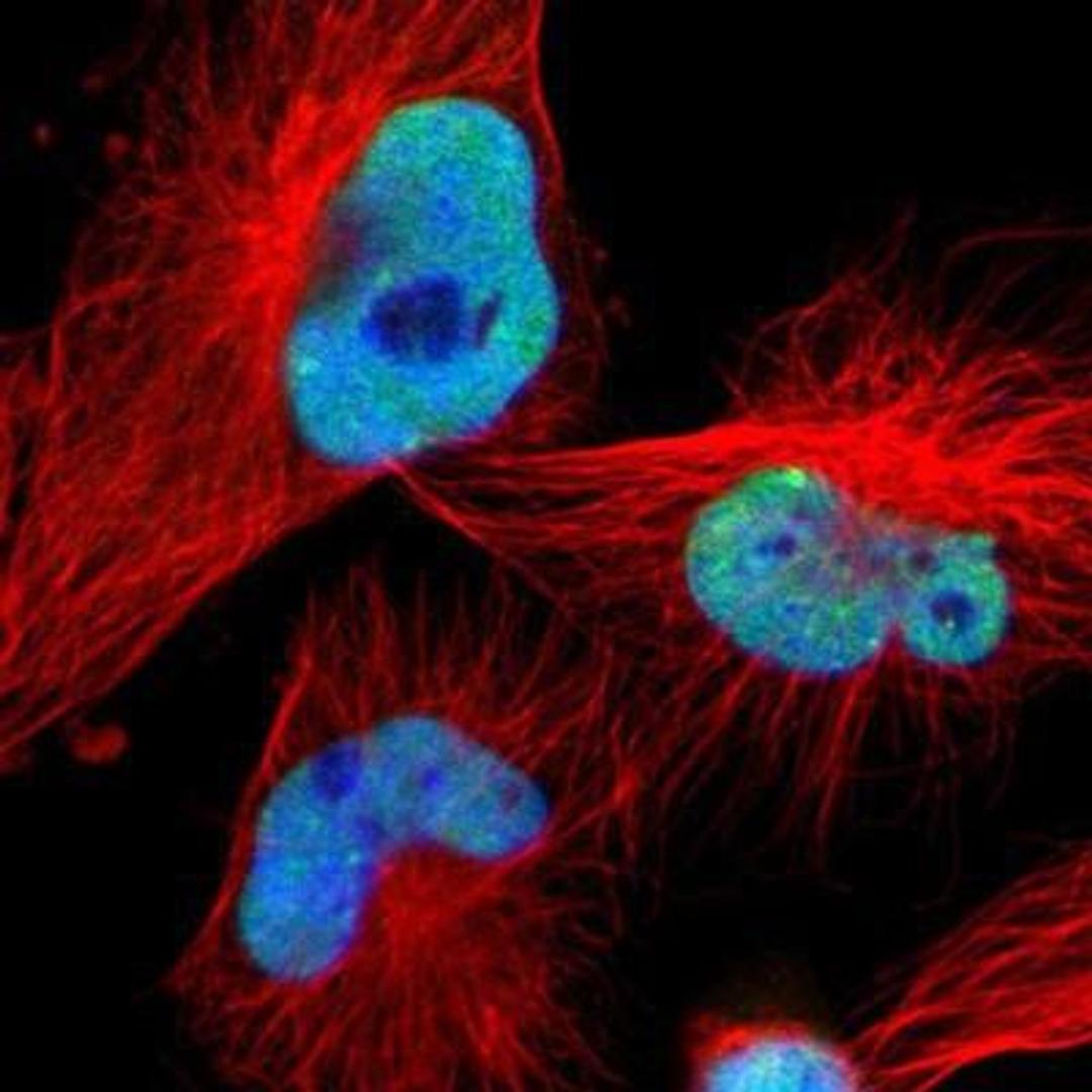 Immunocytochemistry/Immunofluorescence: PAPOLA Antibody [NBP1-87345] - Staining of human cell line U-251MG shows positivity in nuclei but not nucleoli.