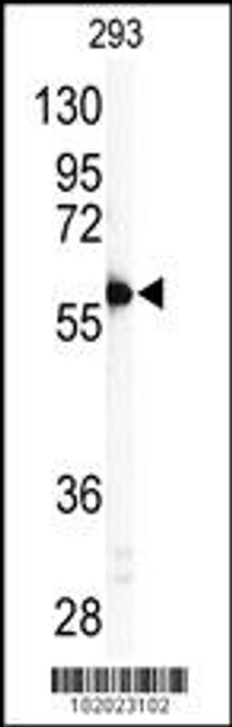 Western blot analysis of anti-MMP11 Antibody in 293 cell line lysates (35ug/lane).