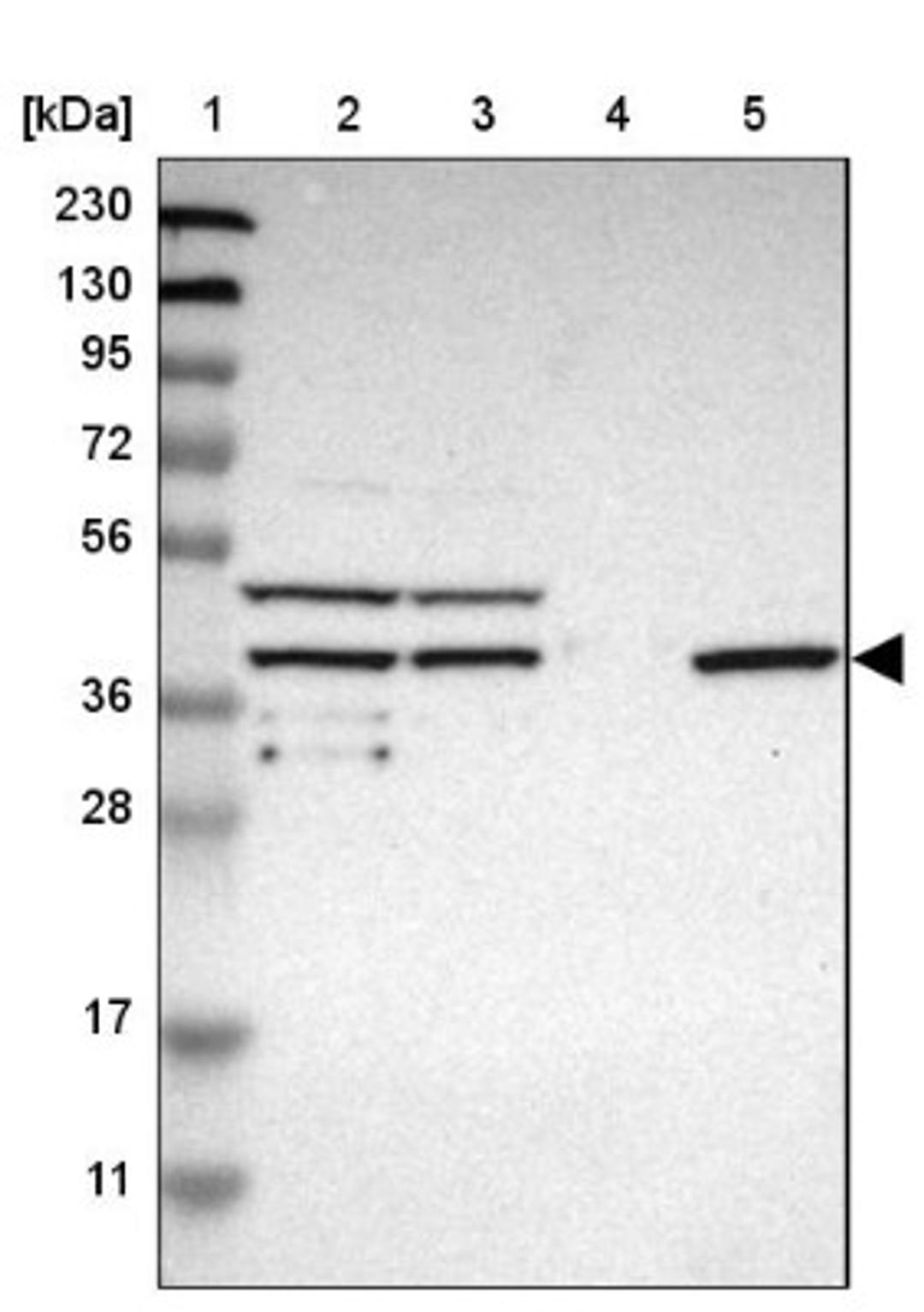 Immunohistochemistry: SLC22A23 Antibody [NBP1-91154] - Lane 1: Marker [kDa] 230, 130, 95, 72, 56, 36, 28, 17, 11<br/>Lane 2: Human cell line RT-4<br/>Lane 3: Human cell line U-251MG sp<br/>Lane 4: Human plasma (IgG/HSA depleted)<br/>Lane 5: Human liver tissue