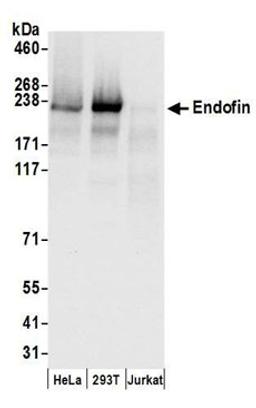 Detection of human Endofin by western blot.