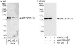 Detection of human SART3/TIP110 by western blot and immunoprecipitation.