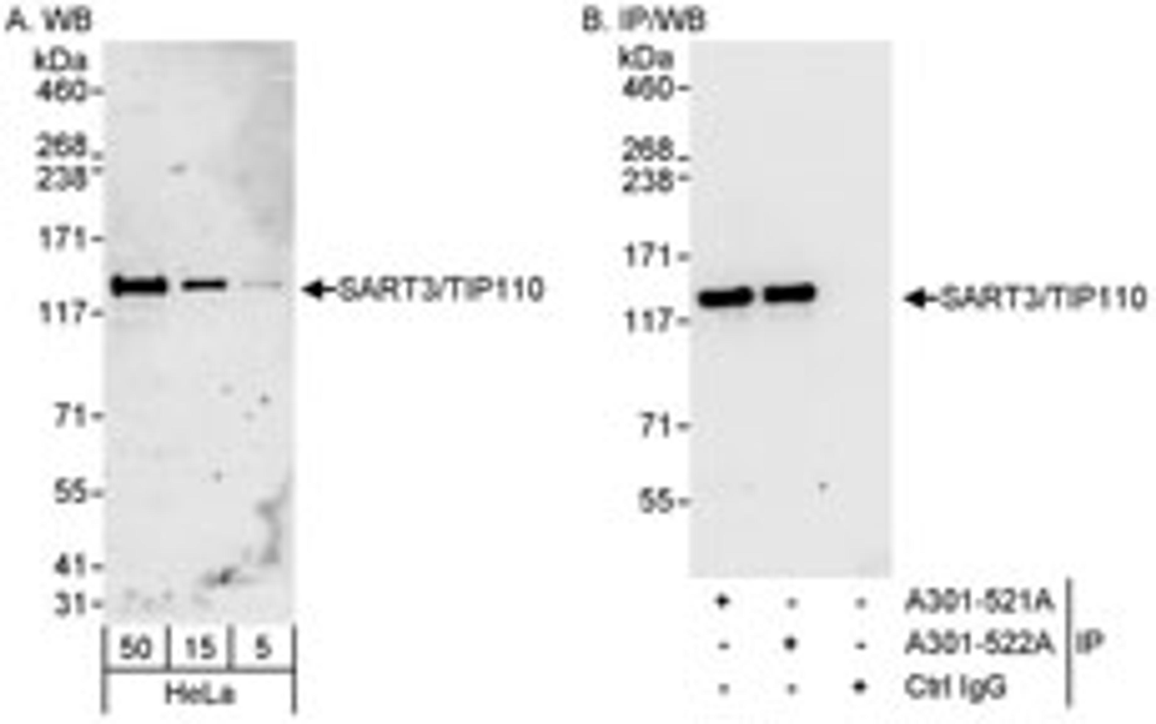 Detection of human SART3/TIP110 by western blot and immunoprecipitation.