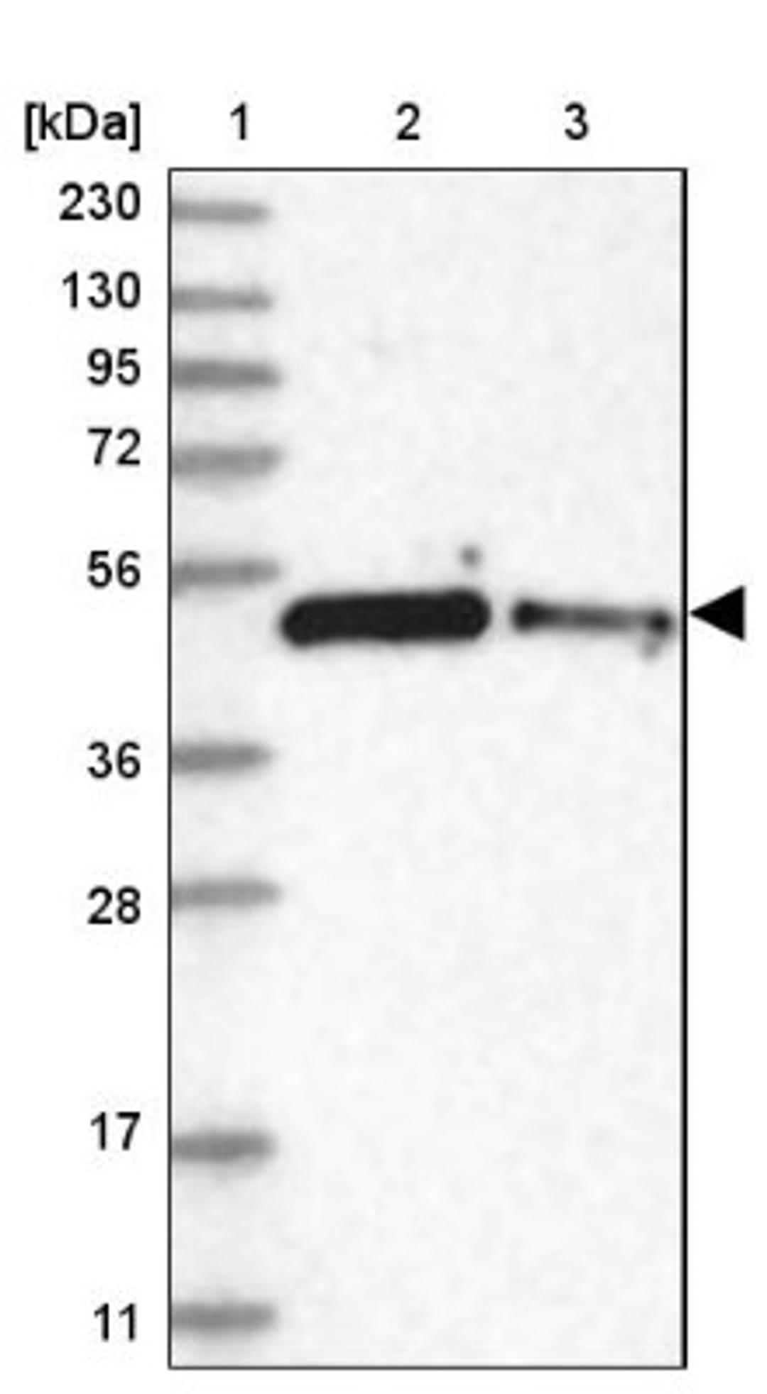 Western Blot: ZNF787 Antibody [NBP1-85911] - Lane 1: Marker [kDa] 230, 130, 95, 72, 56, 36, 28, 17, 11<br/>Lane 2: Human cell line RT-4<br/>Lane 3: Human cell line U-251MG sp